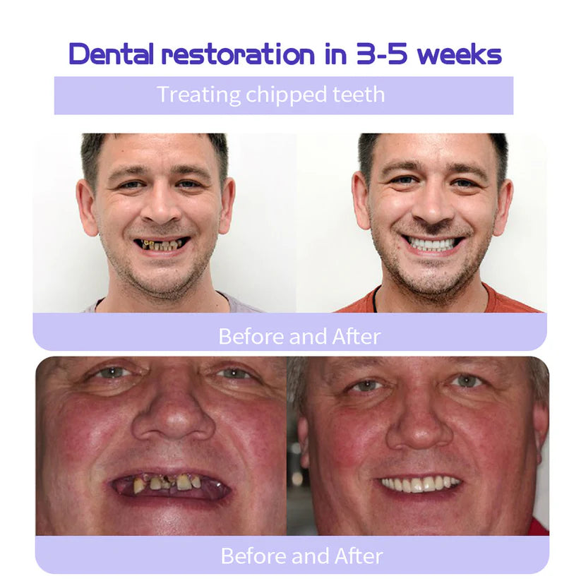 Magic Whitening Toothpaste JEREMYTIS™ Powder with Hydroxyapatite - World's First & Only! Sprinkle or Dip!