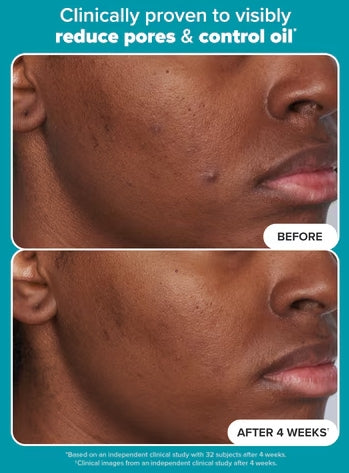 đĽLAST DAY 49% OFFâ¨ODEIUNâ˘- Skin Perfecting 2% BHA Liquid Exfoliant