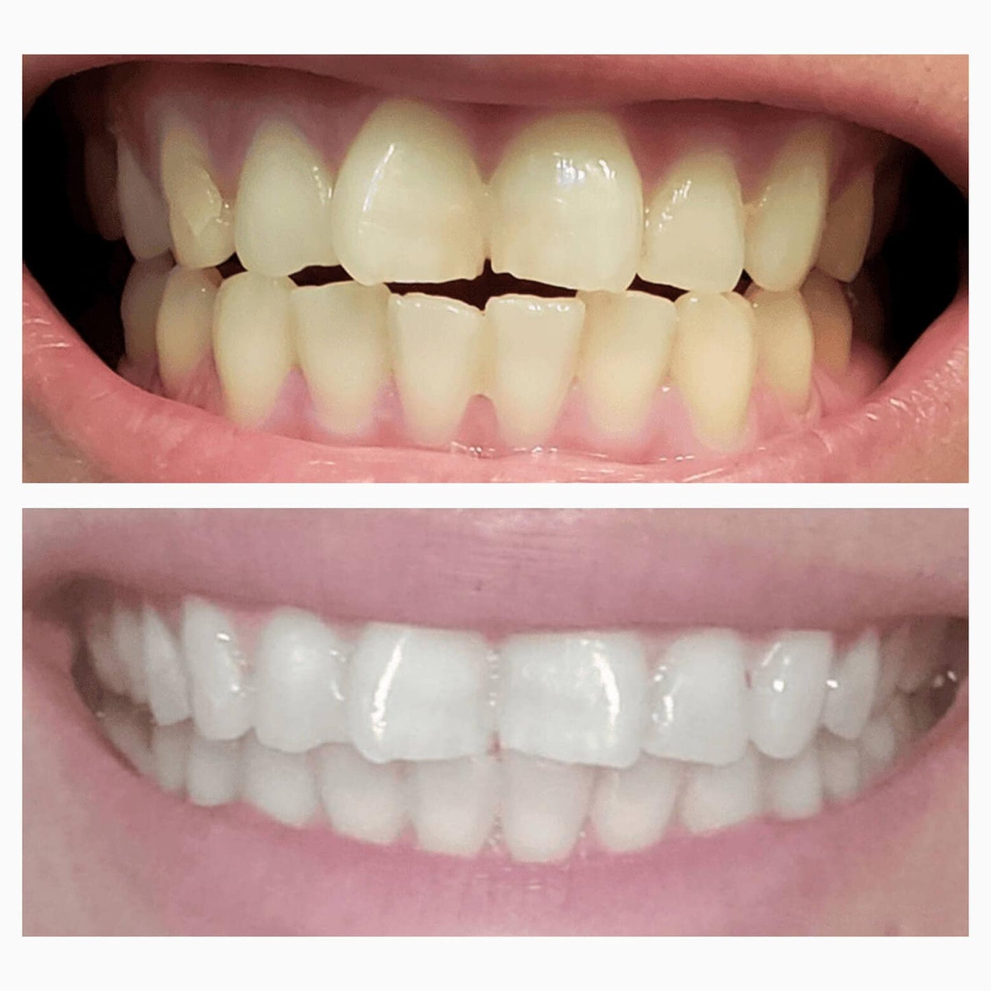 Magic Whitening Toothpaste JEREMYTIS™ Powder with Hydroxyapatite - World's First & Only! Sprinkle or Dip!