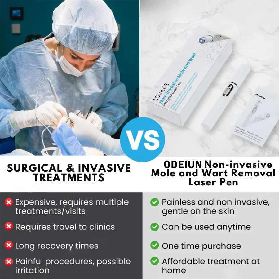 š„ćOFFICIAL STOREćODEIUN⢠Non-Invasive Mole and Wart Removal Laser Pen