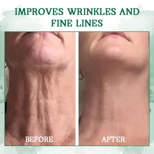 π₯π©ββοΈLast Day Promotion ππ%ππ
π
- SkinFirming Rejuvenating Serumπ₯