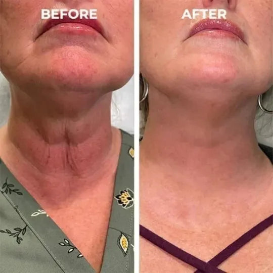 π₯π©ββοΈLast Day Promotion ππ%ππ
π
- SkinFirming Rejuvenating Serumπ₯
