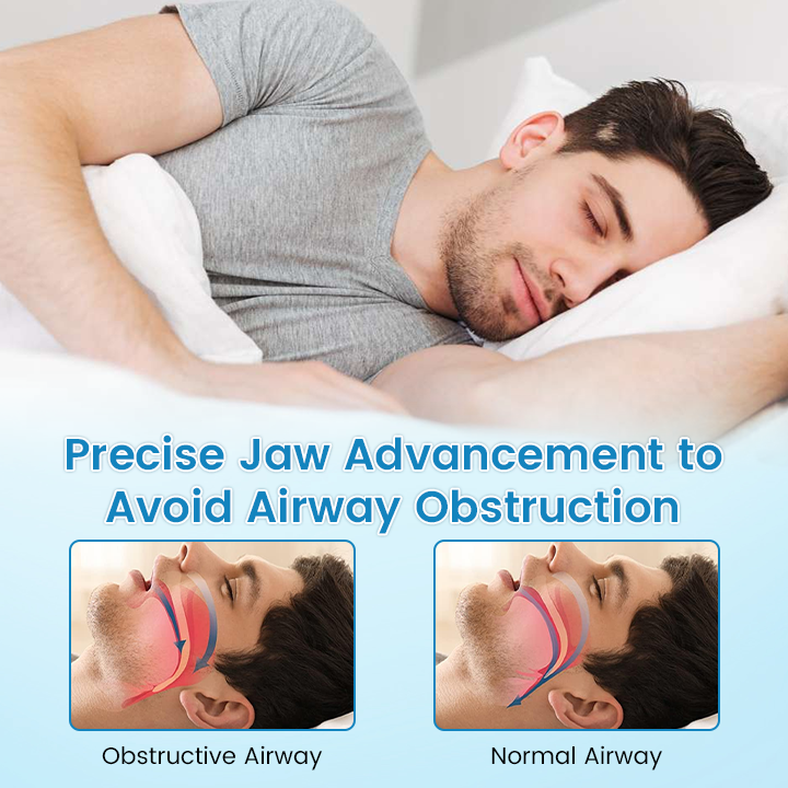 ✨JEREMYTIS™ Anti-Snoring & Anti-Grinding Teeth Protector Universal Size