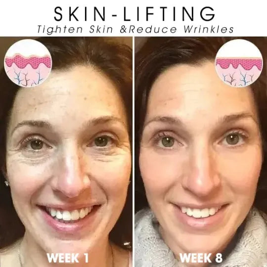 π₯π©ββοΈLast Day Promotion ππ%ππ
π
- SkinFirming Rejuvenating Serumπ₯
