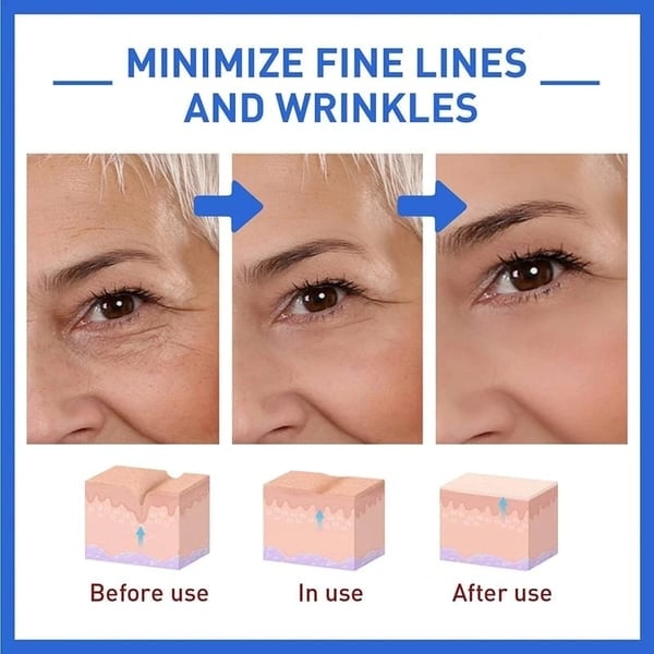 Last Day Promotion 49% OFF - š„Botox Face Serum