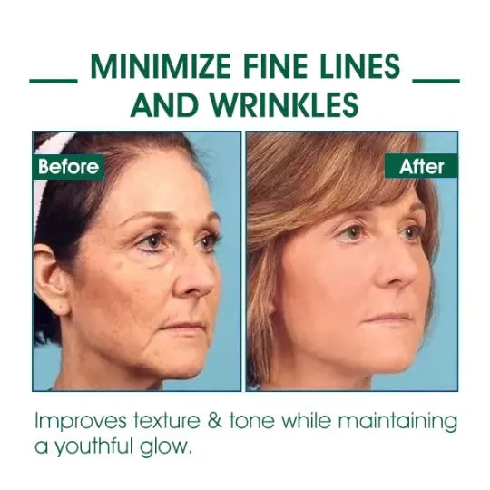 π₯π©ββοΈLast Day Promotion ππ%ππ
π
- SkinFirming Rejuvenating Serumπ₯