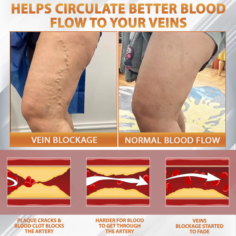 ODEIUN® MicroSting Bee Vein Ease Patches