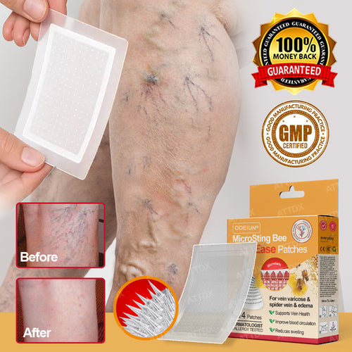 ODEIUN® MicroSting Bee Vein Ease Patches