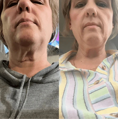 š„Last Day 70% OFFš„-ODEIUN⢠Tighten & Lift Neck Cream