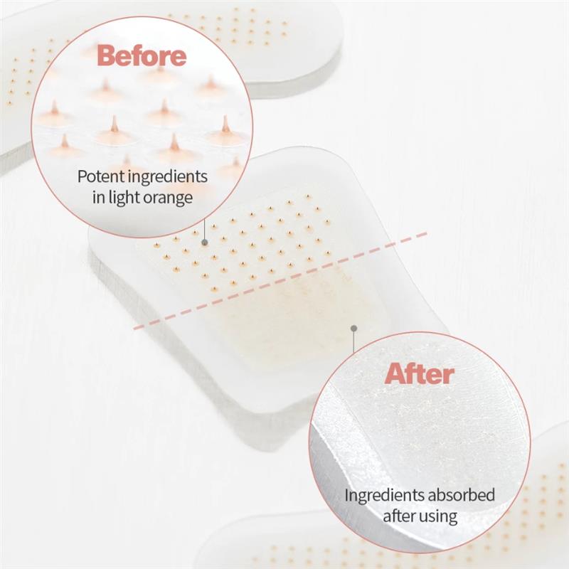 ODEIUN® MicroSting Bee Vein Ease Patches