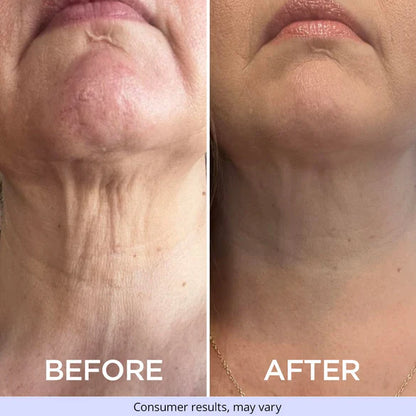 🔥Last Day 70% OFF🔥-ODEIUN™ Tighten & Lift Neck Cream